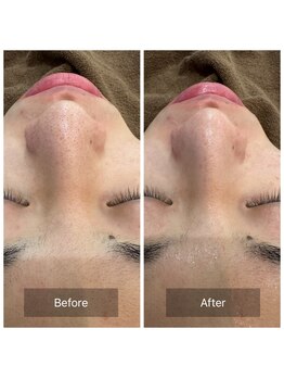 ゴホウビ オキナワ(GOHOBI OKINAWA)/毛穴が締まるとトーンも上がる♪