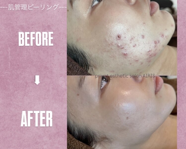 アイリス(AIRIS)|ホットペッパービューティー アイリス(AIRIS)|ホットペッパービューティー