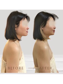 オルオル(.olu olu)/猫背改善&小顔リフトアップ