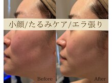 ベルダ(BELDAD)の雰囲気（東海地方希少！SNS話題小顔メニュー）