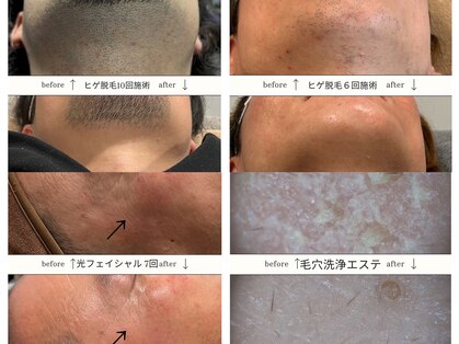 スキンジム(SKIN GYM)の写真