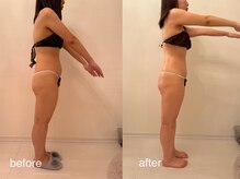 クロレ 浦和店(CLORE)/20代のお客様/18回施術