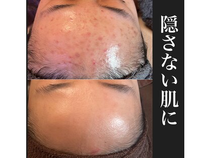 アーブル(Agreable)の写真