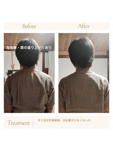 蔵しん/タイ古式９０分ビフォーアフター