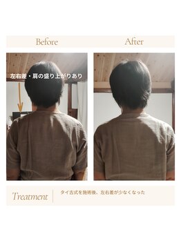 蔵しん/タイ古式９０分ビフォーアフター