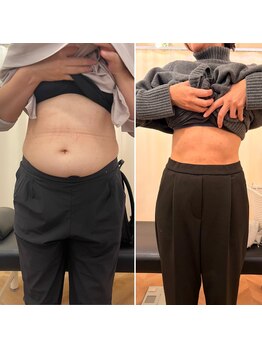 ナオ接骨院(NAO接骨院)/Before/After