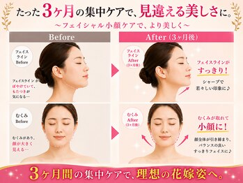 ベルビー エルエル岡崎店/小顔美ラインヘ