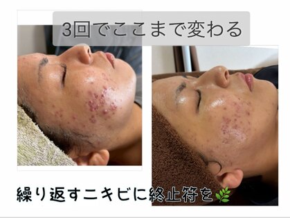 エクレ(eclat)の写真