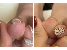 ユマニ バイ ヒート(Humani by HEAT)/