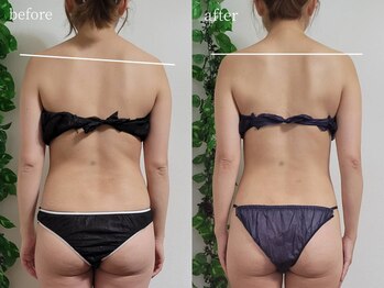 ティティビューティ ラ・クエージ金山(TTBeauty)/SP120分 骨格別痩身