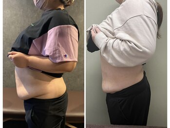 マイティー整骨院 ココア(CoCoa)/最新マシン×トレーニング