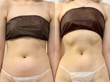 ルーナジェーナ(Luna llena)/池袋　エステ　ルーナジェーナ