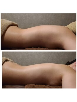 ウォーマル(warmaL)/肩こり 不眠改善