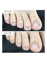 ネイルアトリエ ボン(nail atelier bon)/フットネイルケア