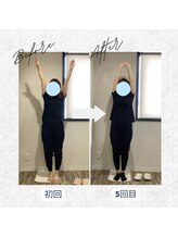 ラクリエ 東加古川院(La Creer)/お客様ビフォーアフター