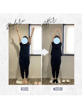 ラクリエ 東加古川院(La Creer)/お客様ビフォーアフター