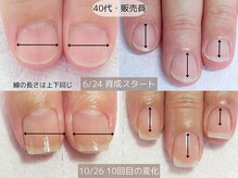 エヌプラス(Nplus)/美爪育成３ヵ月コース