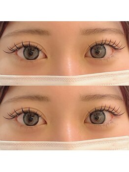 ユーロ(EURO)/バインドロックデザイン♪