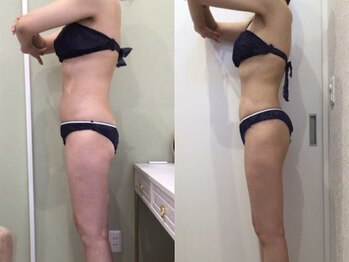 ビラ 銀座店(BILA)/キャビラジ