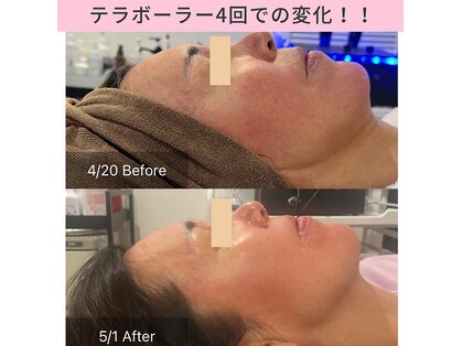 癒える(ielu)の写真