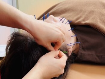 和燈の写真/【初めての方も大歓迎◎】お顔も身体もどちらの施術も受けられる!女性のための完全個室サロン◇