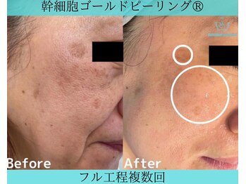 リメイク 広尾(REMAKE)/