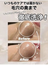 ビレボ マエバシ(BEREVO maebashi)/Before After