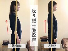 アライメント 恵比寿(Alignment)/反り腰改善♪
