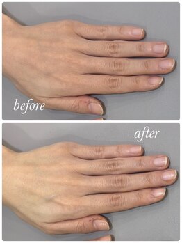ハンドケアビフォーアフター