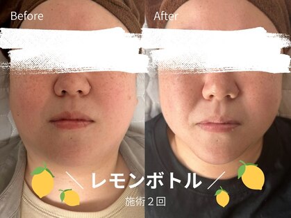 ルル(Lulu)の写真