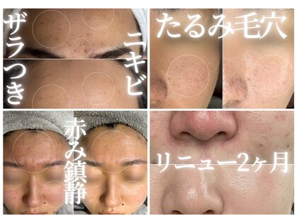 エイル(EILE)の写真