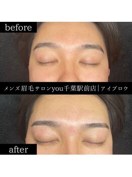 ユー 千葉駅前店(you)/ビフォ－アフター写真