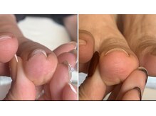 ユマニ バイ ヒート(Humani by HEAT)/