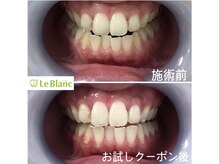 ルブラン 奈良店(Le Blanc)/何処へ行こうかなとお悩みの方