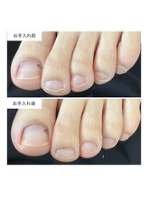 ネイルアトリエ ボン(nail atelier bon)/フットネイルケア