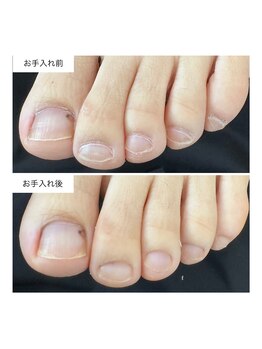 ネイルアトリエ ボン(nail atelier bon)/フットネイルケア