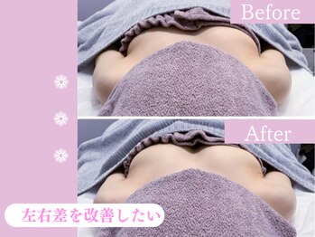 キアナ 横浜店(Kiana)/左右差にお悩みの方Before After