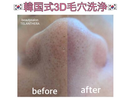 ビューティサロンテランセラ(beauty salon TELANTHERA)の写真