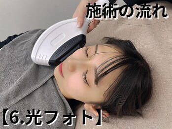 アルゴ 八幡黒崎店(ALGO)/施術の流れ【6.光フォト】