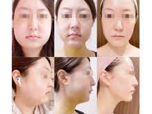 痛みも、不安も、知っているからこそ寄り添える術前後ケア