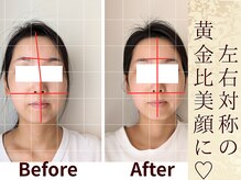 スウ(suu.)/Before-After【30代】12 回