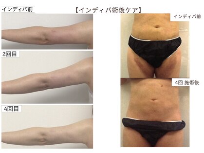 ホロス トウキョウ(HOLOS TOKYOの写真
