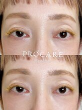プロケア 新宿本店(PROCARE)/シングルラッシュ140本