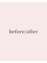 ミミバスト(mimibust)/before after↓