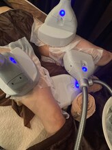 ブルースター(Blue Star)/脂肪冷却4カップ施術風景