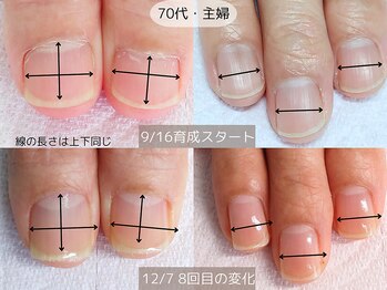 エヌプラス(Nplus)/美爪育成３ヵ月コース