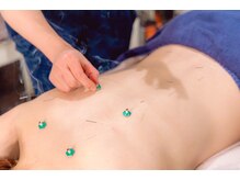 モイサ(MOISA)の雰囲気（リラクゼーションサロンのようなお一人様貸切の空間で受ける鍼灸）