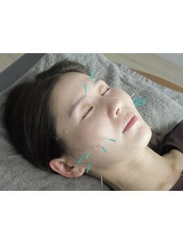 小顔になりたい