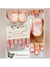 エッセンス (Essence)/小さな"不調"、早めに改善◎