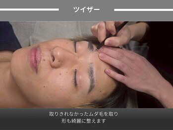 アポロ(Apollo)/ツイザー